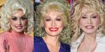 Dolly Parton Plastic Surgery