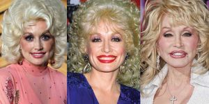 dolly parton plastic surgery