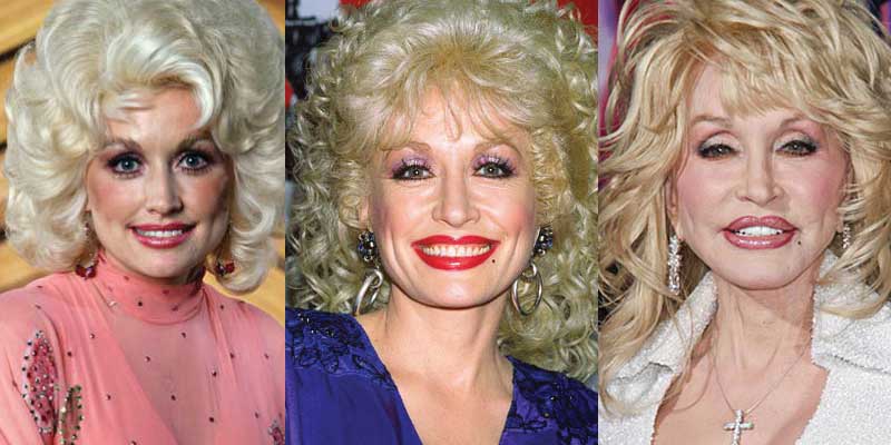 dolly parton plastic surgery