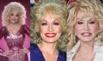 Dolly Parton Plastic Surgery