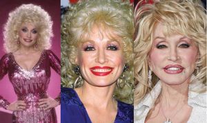 dolly parton plastic surgery