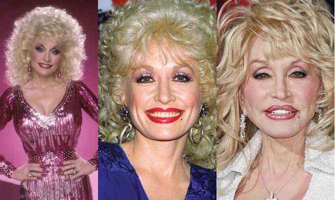 Dolly Parton Plastic Surgery Before and After 2023