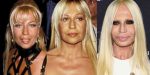 Donatella Versace Plastic Surgery