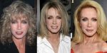 Donna Mills Plastic Surgery