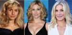 Elizabeth Mitchell Plastic Surgery