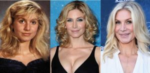 elizabeth mitchell plastic surgery