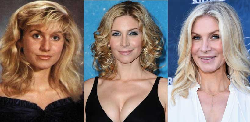 Stephanie Pratt Plastic Surgery. 