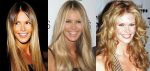 Elle Macpherson Plastic Surgery