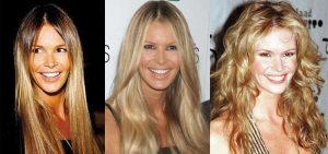 elle macpherson plastic surgery