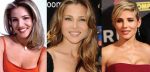 Elsa Pataky Plastic Surgery