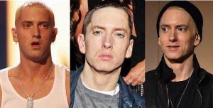 eminem plastic surgery