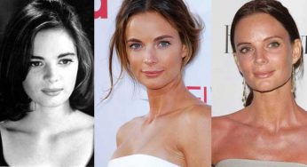 Gabrielle Anwar Plastic Surgery