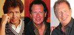 Garry Shandling Plastic Surgery