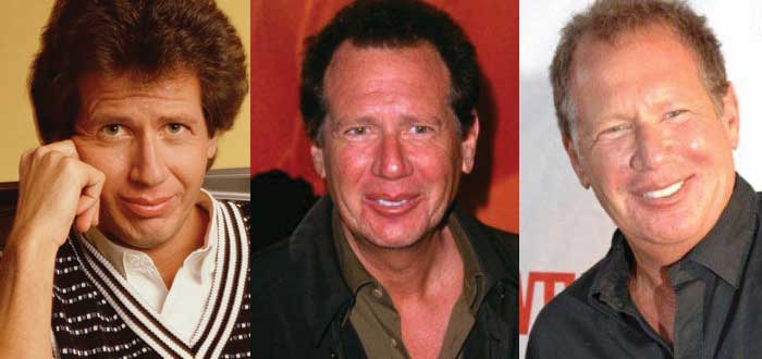 garry shandling plastic surgery