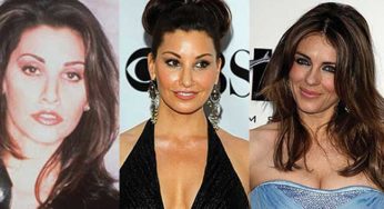 Gina Gershon Plastic Surgery