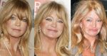 Goldie Hawn Plastic Surgery