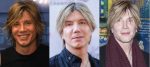 Goo Goo Dolls Lead Singer Plastic Surgery