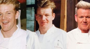 Gordon Ramsay Plastic Surgery