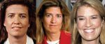 Greta Van Susteren Plastic Surgery