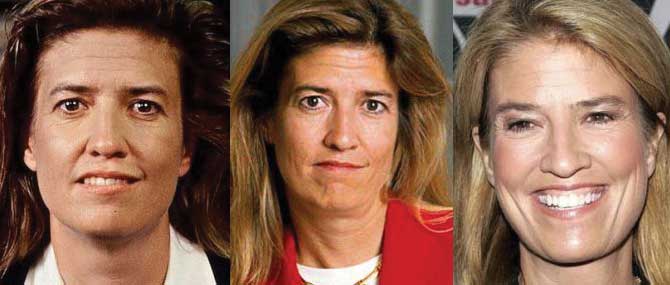 greta van susteren plastic surgery