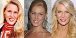 Gretchen Rossi Plastic Surgery