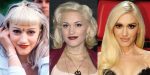 Gwen Stefani Plastic Surgery