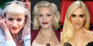 gwen stefani plastic surgery