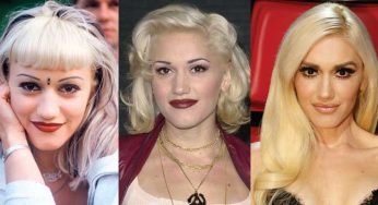 Gwen Stefani Plastic Surgery