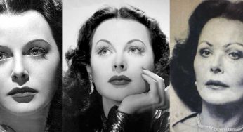 Hedy Lamarr Plastic Surgery