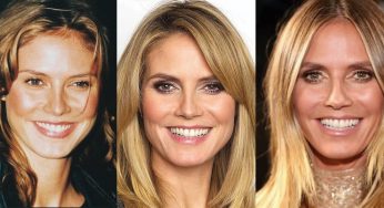 Heidi Klum Plastic Surgery