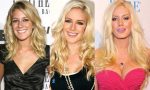 Heidi Montag Plastic Surgery