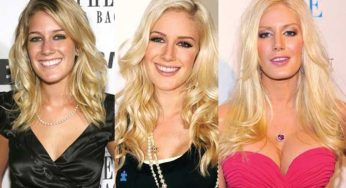 Heidi Montag Plastic Surgery