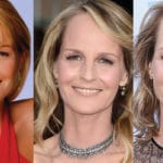 Helen Hunt Plastic Surgery