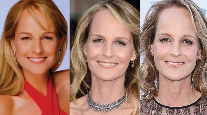 Helen Hunt Plastic Surgery Before and After 2023