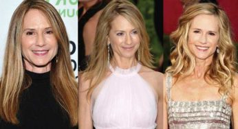 Holly Hunter Plastic Surgery