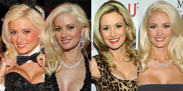 Holly Madison Plastic Surgery Before and After Pictures 2025