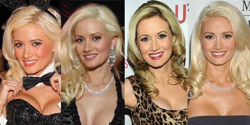 holly madison plastic surgery