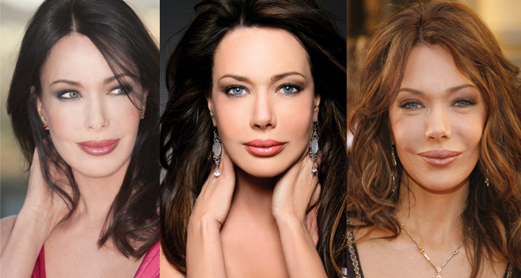 hunter tylo plastic surgery