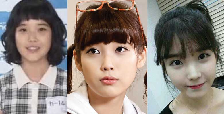 IU Plastic Surgery Before and After 2024