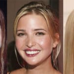 Ivanka Trump Plastic Surgery