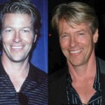 Jack Wagner Plastic Surgery