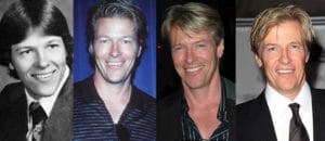 jack wagner plastic surgery