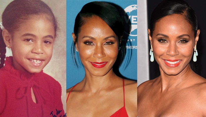 jada pinkett smith plastic surgery