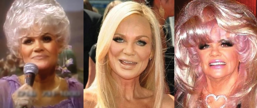 Jan Crouch Plastic Surgery Before and After 2022