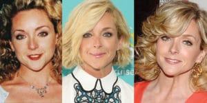 jane krakowski plastic surgery