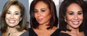 jeanine pirro plastic surgery