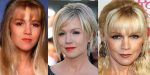 Jennie Garth Plastic Surgery