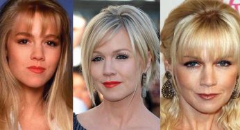 Jennie Garth Plastic Surgery