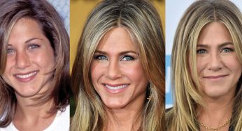 Jennifer Aniston Plastic Surgery