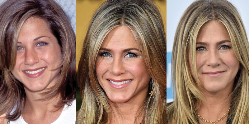 Jennifer Aniston Plastic Surgery Before and After 2023